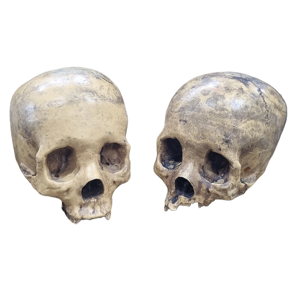 Human Skull #2: Resin Yellow (H: 14cm x L: 18cm x W: 13cm)