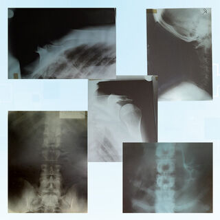 X-rays assorted