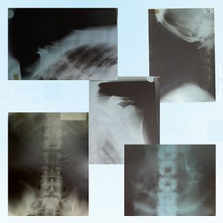 X-rays assorted
