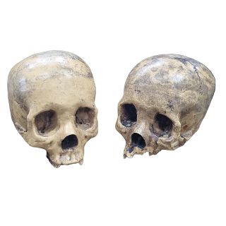 Human Skull #2: Resin Yellow (H: 14cm x L: 18cm x W: 13cm)